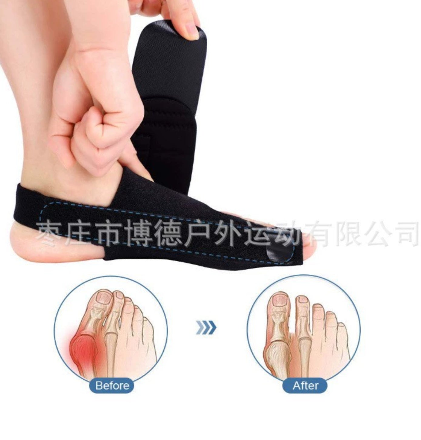 C66 Neoprene Bunion Corrector with Toe Separator and Forefoot Cushion – Hallux Valgus Support Pad