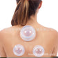 Cupping acupuncture cups creating suction to promote blood circulation and muscle relaxation