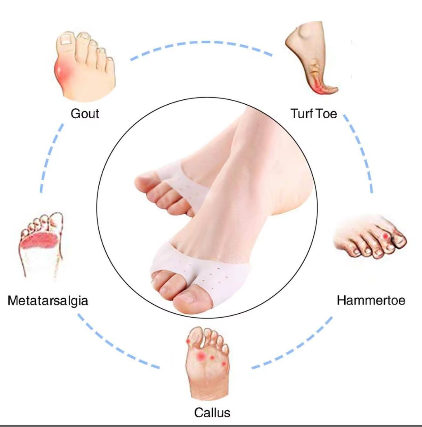 shock absorbing forefoot pad