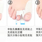 gel toe spacer
